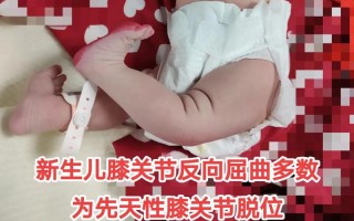 新生儿膝盖骨头响是正常发育现象还是骨骼异常信号？