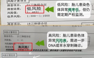 孕期糖筛究竟是在检查哪些关键指标，对母婴健康又有哪些重要意义呢？