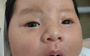 新生儿一只眼睛睁开一只闭着是正常现象吗？需要担心吗？