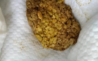 新生儿便便里的奶瓣正常吗？附图片详解不同形态代表什么？