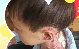 孕期吃辣条会影响胎儿吗？