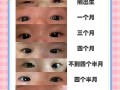 新生儿眼睛一大一小咋办？
