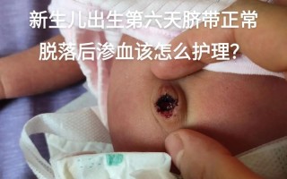 新生儿脐带脱落后出血怎么办？需要立即就医还是在家观察处理？