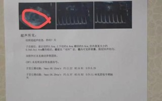 孕期做六次B超是否过度？会对胎儿有影响吗？