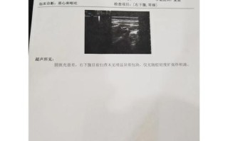 儿童医院发烧挂什么科