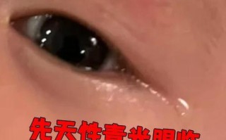 新生儿眼睛被强光刺激后，会留下永久性损伤吗？
