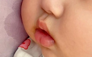 新生儿睡觉流口水是正常现象吗？