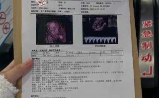 孕期大排畸都检查什么