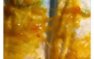 新生儿大便出现血丝和粘液是何原因？需要立即就医还是可在家观察？