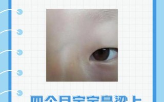 新生儿鼻子发黑是缺氧还是正常现象？需要警惕哪些健康问题？