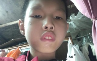 13岁智力低下有哪些具体表现？