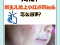 新生儿鼻头小白点是何原因？