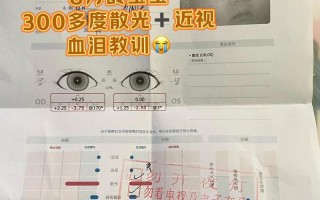 儿童散光300度能自愈吗？