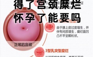怀孕期间重度宫颈糜烂对胎儿有影响吗？该如何安全治疗？