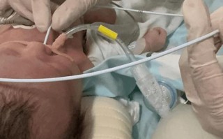 新生儿做胸片检查的辐射剂量究竟有多大？会对宝宝健康造成潜在风险吗？