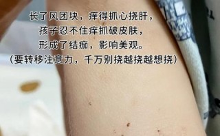 孩子身上莫名起包又痒，到底是什么原因导致的呢？