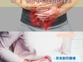 孕期肠痉挛有哪些典型症状？如何区分与普通腹痛？