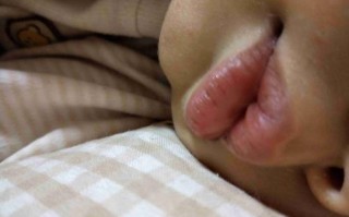 新生儿嘴唇颜色偏红紫是缺氧还是正常生理现象？需警惕哪些潜在问题？