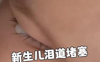 新生儿泪腺管不通症状