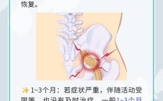 孕期坐骨神经痛真能预示胎儿性别是男孩吗？科学依据在哪里？