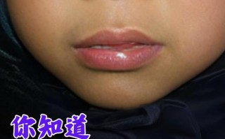 新生儿宝宝上嘴唇突出是正常发育还是异常信号？需警惕哪些潜在问题？