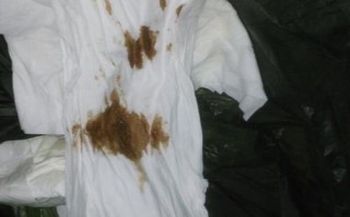 怀孕期间流出黑色粘稠物是先兆流产还是其他异常情况？