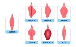 孕期阴道内侧长小颗粒是什么原因？需要担心吗？