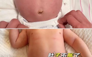 新生儿肚子拍得蹦蹦响是正常现象还是健康预警？拍打力度和频率该如何把握？