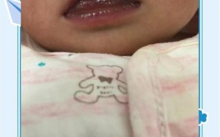 新生儿嘴周发青是缺氧还是其他问题？