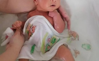 新生儿出生后多久才开始长肉肉？是越快越好吗？