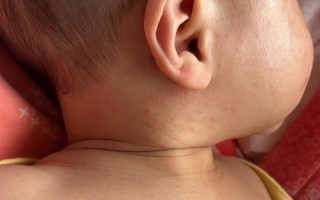 新生儿宝宝身上出现红点点是正常现象还是需要警惕的皮肤问题？