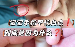 儿童指甲白点是缺钙还是生病了？