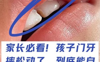 儿童门牙松动一直不掉怎么办？