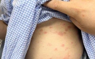 新生儿吸吮能力差具体有哪些症状表现？