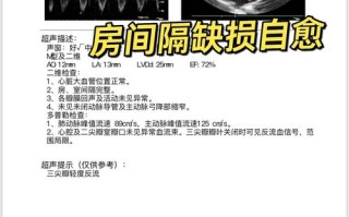 新生儿房间隔缺损都会自愈吗？需要家长注意哪些关键问题？