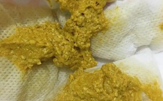 新生儿拉粑粑声音很大，是正常现象还是肠胃异常？