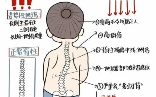 10岁儿童脊柱侧弯怎么办？