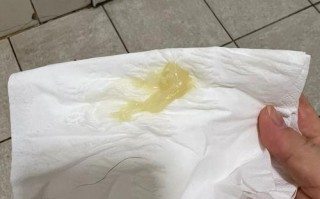 孕期白带像黄鼻涕一样，是正常现象还是感染信号？需要警惕哪些问题？