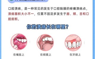 儿童口腔溃疡频发，是缺营养还是免疫力差？