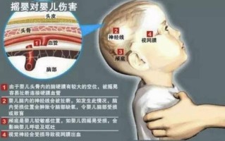 新生儿头颅血肿有何特点？如何识别与科学护理？