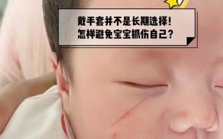 新生儿脸上抓破了怎么办？日常护理与伤口愈合全攻略