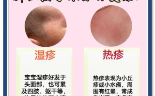 新生儿湿疹怎么办？