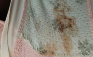 孕期白带发红又不像血