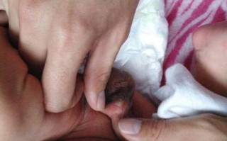 新生儿水肿背后的元凶有哪些？新手爸妈该如何应对与排查？