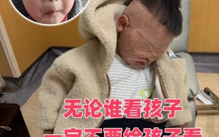 儿童玩手机，眼睛危害究竟有多严重？