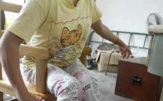 我国儿童擦腿症有多少