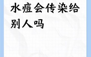 儿童水痘传染性强，大人接触后会被感染吗？成人感染后症状会更严重吗？