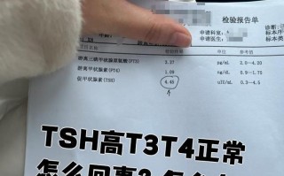 新生儿甲状腺T4偏低会影响发育吗？需要如何干预治疗？