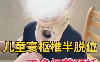 儿童寰枢关节半脱位治疗首选什么方法？