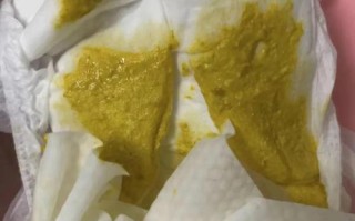 新生儿吃奶粉为何会营养不良？奶粉选择与喂养方式需注意哪些关键问题？